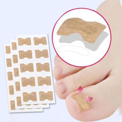 Ingrown Toenail Adjustment Patch