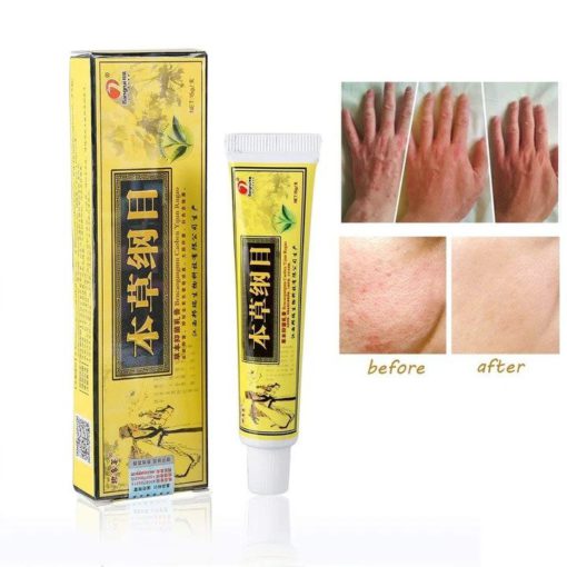 Advanced Psoriasis & Eczema Natural Herbal Cream - Image 2