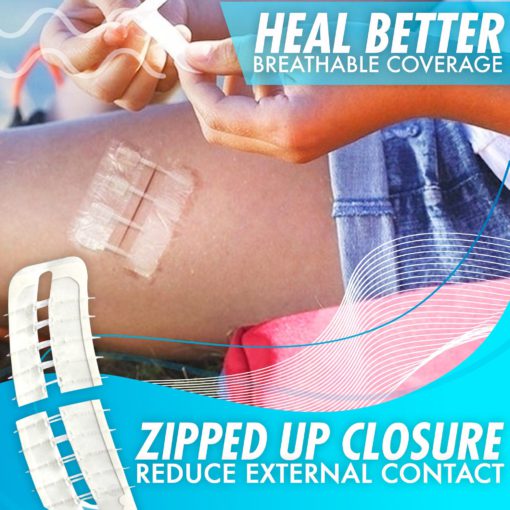 Recovery Closure Enhancing Zipped Up Patch