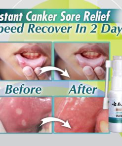 Mouth And Throat,Oral Spray,Throat Sore,Mouth And Throat Sore,Oral