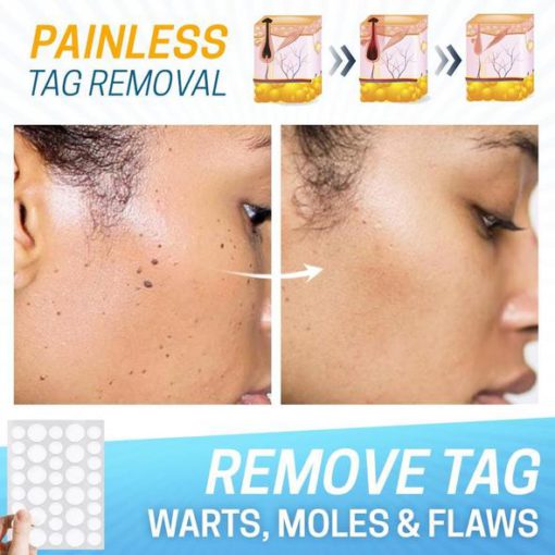 Skin Tag Pain-Free Remover Patch,Remover Patch,Skin Tag,Pain-Free