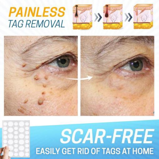 Skin Tag Pain-Free Remover Patch - Image 4