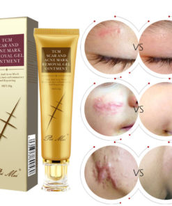 TCM Acne Scar Cream,Acne Scar Cream,Scar Cream,Acne Scar,TCM Acne Scar