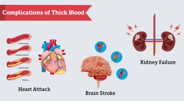 Natural Blood Thinners