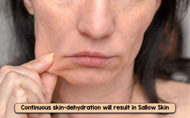 Sallow Skin