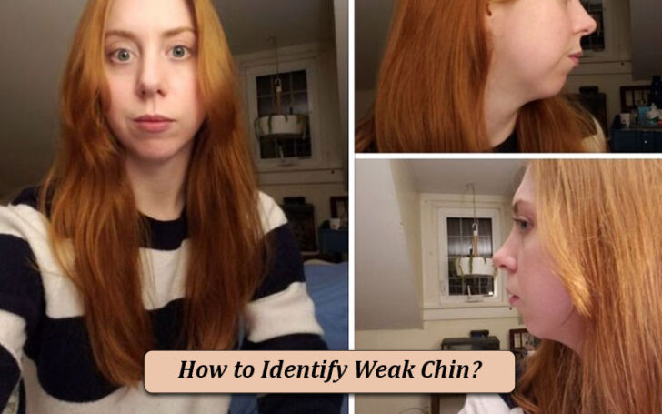 Weak Chin