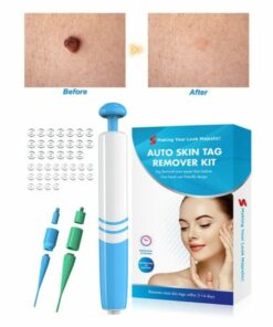 Auto Skin Tag Removal Kit