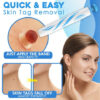 Auto Skin Tag Removal Kit