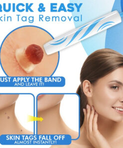 Auto Skin Tag Removal Kit