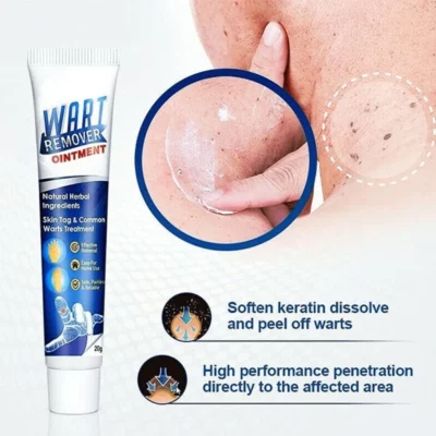 WartsOff Instant Blemish Removal Cream