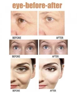 Wrinkle & Dark Circle Reducing Eye Serum