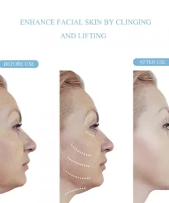 Face Lifting Tape Strips For A Beautifully Slim Face