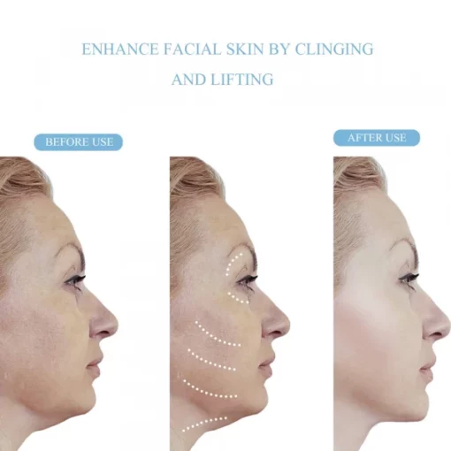 Face Lifting Tape Strips For A Beautifully Slim Face