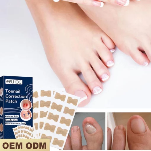 Toenail Corrector Patch (30 Pack)