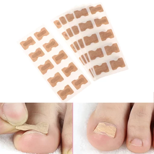 Toenail Corrector Patch (30 Pack)